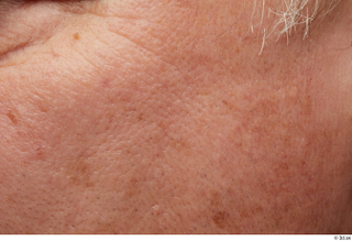 HD Face Skin Riley Evans cheek face skin texture wrinkles…